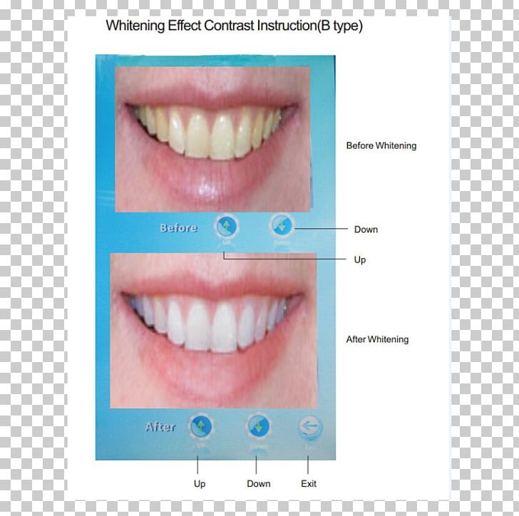 Close-up PNG, Clipart, Cheek, Chin, Closeup, Closeup, Cosmetic Dentistry Free PNG Download