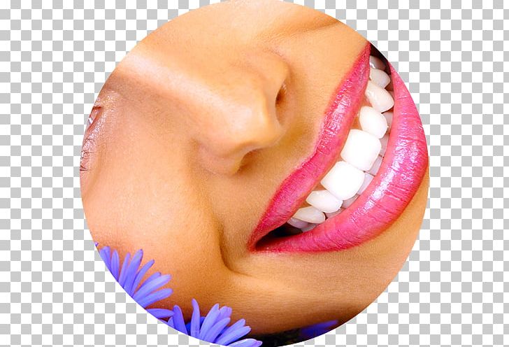 Tooth Whitening Indoor Tanning Lip Human Tooth PNG, Clipart, Cheek, Chin, Closeup, Cosmetic Dentistry, Dentistry Free PNG Download
