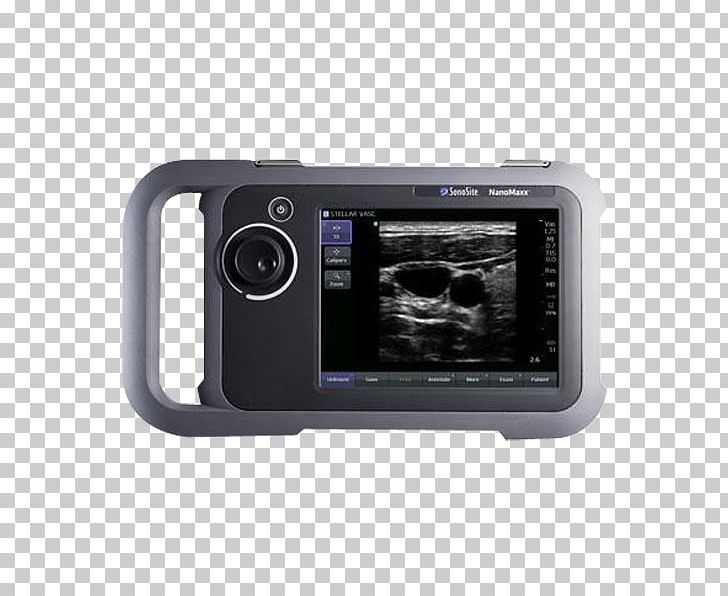 Ultrasonography Ultrasound Ecógrafo Medicine SonoSite PNG, Clipart, Bildgebendes Verfahren, Camera, Cameras Optics, Computer, Diagnose Free PNG Download