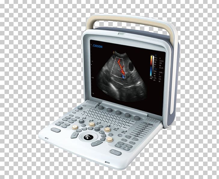 Ultrasonography Portable Ultrasound Doppler Echocardiography Medical Equipment PNG, Clipart, Breast Ultrasound, Doppler, Electronics, Ge Healthcare, Hardware Free PNG Download