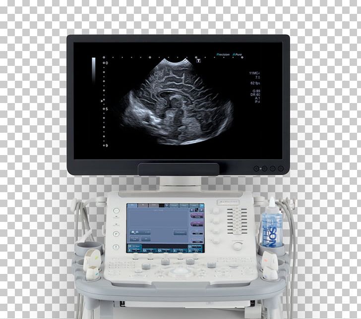 Medical Equipment Ultrasonography Medicine Medical Imaging Medical Diagnosis PNG, Clipart, Angiology, Display Device, Electronics, Gynaecology, Health Care Free PNG Download
