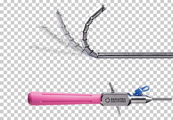 Goldfinger Ethicon Inc. Bariatric Surgery Laparoscopy PNG, Clipart, Adjustable Gastric Band, Angle, Bariatrics, Bariatric Surgery, Ethicon Inc Free PNG Download