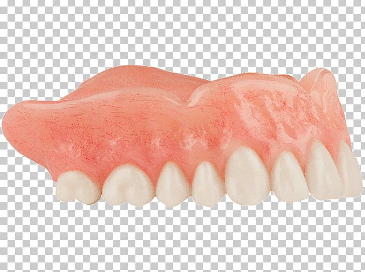 Human Tooth Dentures PNG, Clipart, Denture, Dentures, Human Tooth, Jaw, Lip Free PNG Download
