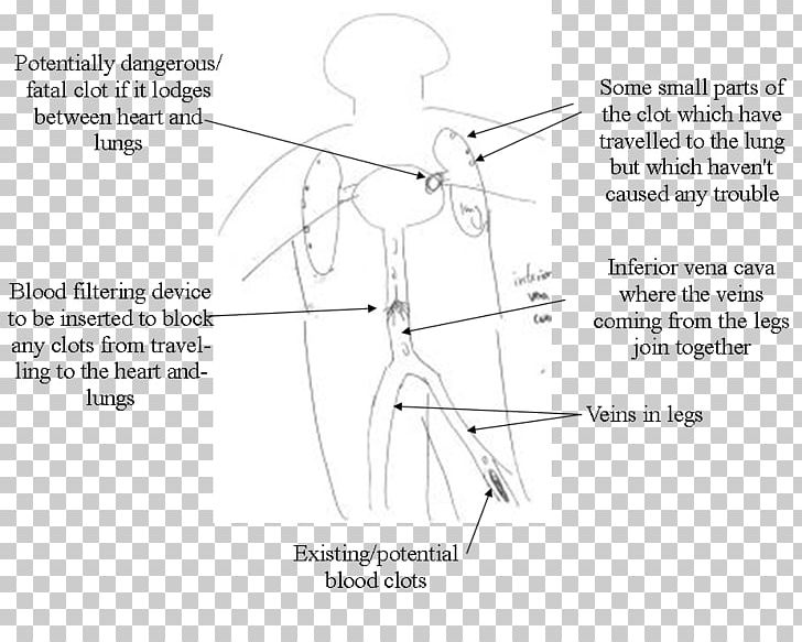 Drawing Product Design Diagram Point PNG, Clipart, Angle, Area, Black And White, Blood Blots, Diagram Free PNG Download
