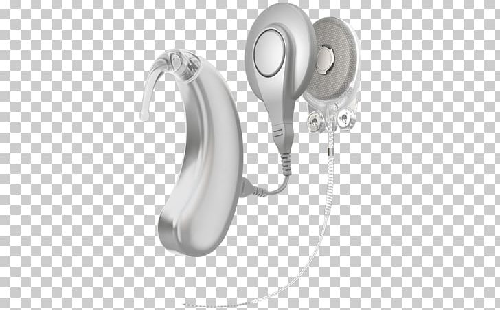 Cochlear Implant Hearing PNG, Clipart, Audio, Audio Equipment, Body Jewelry, Boneanchored Hearing Aid, Bone Conduction Free PNG Download