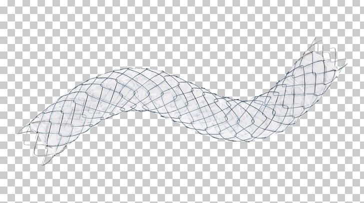 Stenting Self-expandable Metallic Stent Bile Duct Duodenum Palliative Care PNG, Clipart, Angle, Bile Duct, Bowel Obstruction, Duodenum, Endoscopic Ultrasound Free PNG Download