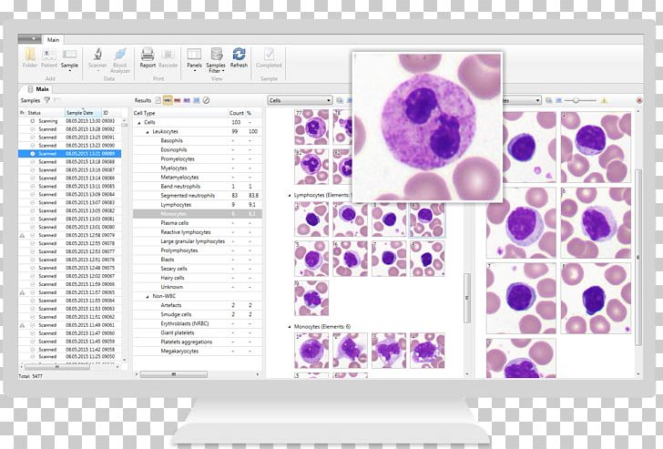 Hematology Complete Blood Count White Blood Cell Microscope PNG, Clipart, Analysis, Area, Blood, Blood Test, Brand Free PNG Download