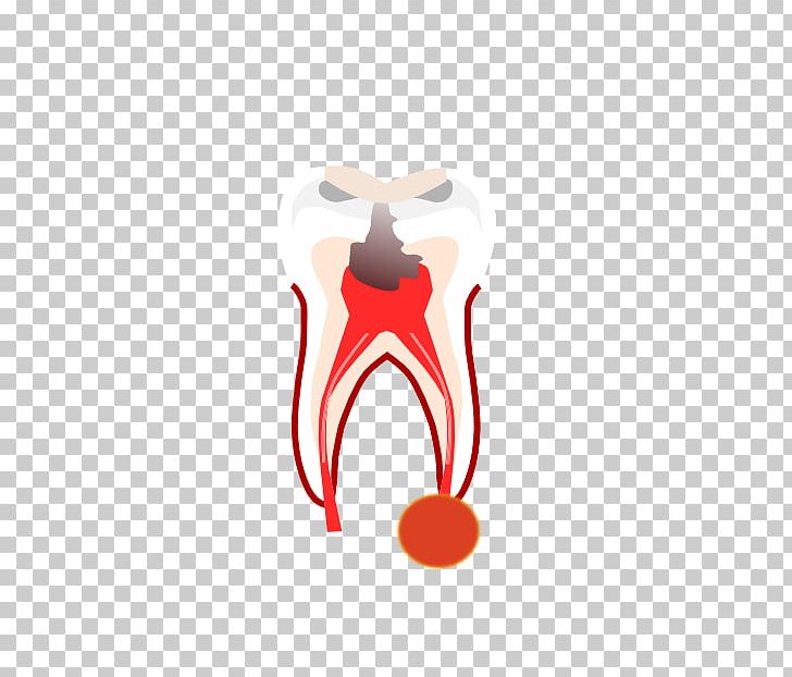 Dentistry Root Canal Crown Tooth Dentures PNG, Clipart, Aesthetics, Bridge, Computer Wallpaper, Crown, Damaged Tooth Free PNG Download