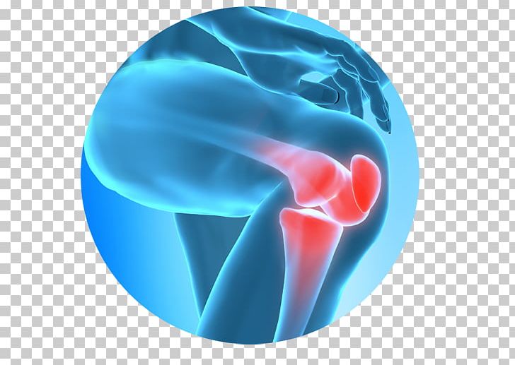 Knee Pain Therapy Pain Management Joint Pain Surgery PNG, Clipart, Ache, Aqua, Arthritis, Blue, Electric Blue Free PNG Download