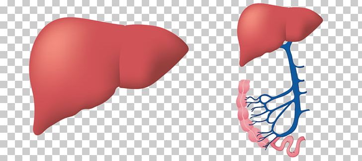 Liver Disease Ionis Pharmaceuticals Fatty Liver PNG, Clipart,  Free PNG Download