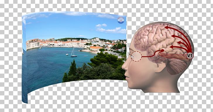 Headgear Brain Research Jaw Vacation PNG, Clipart, Brain, Brain Research, Cap, Headgear, Jaw Free PNG Download