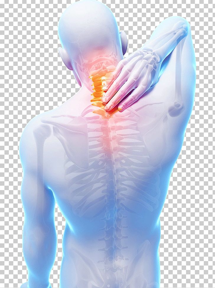 Neck Pain Myofascial Pain Syndrome Muscle Pain Chronic Pain PNG, Clipart, Abdomen, Arm, Back, Back Pain, Chest Free PNG Download
