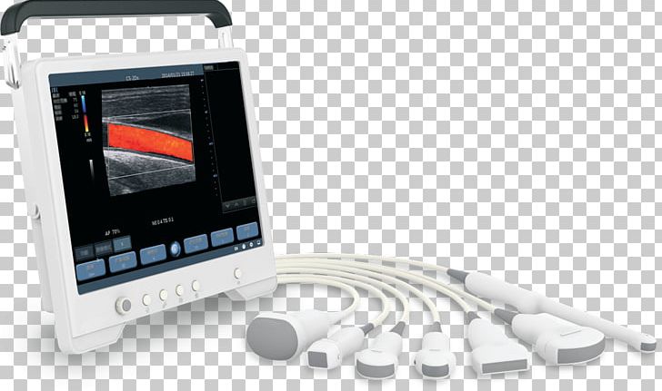 Ultrasonography Doppler Echocardiography Ultrasound Medical Imaging Medical Equipment PNG, Clipart, Angiography, Animals, Communication, Dog, Doppler Free PNG Download