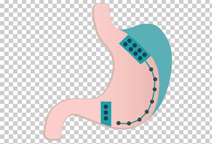 Obesity Surgery Therapy Endoscopy Medical Diagnosis PNG, Clipart, Abdominal Obesity, Appetite, Clinic, Endoscopy, Finger Free PNG Download