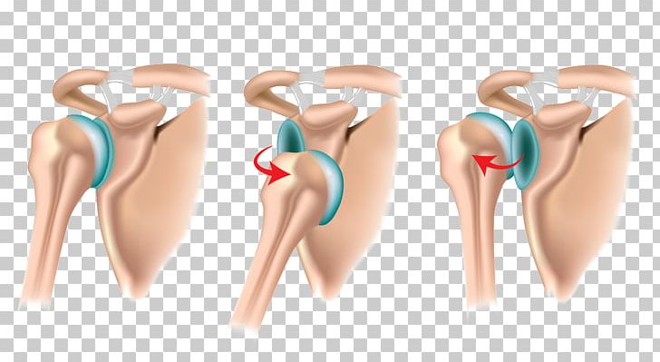 Dislocated Shoulder Joint Dislocation Shoulder Problem Impingement Syndrome PNG, Clipart, Abdomen, Ache, Active Undergarment, Arm, Hand Free PNG Download