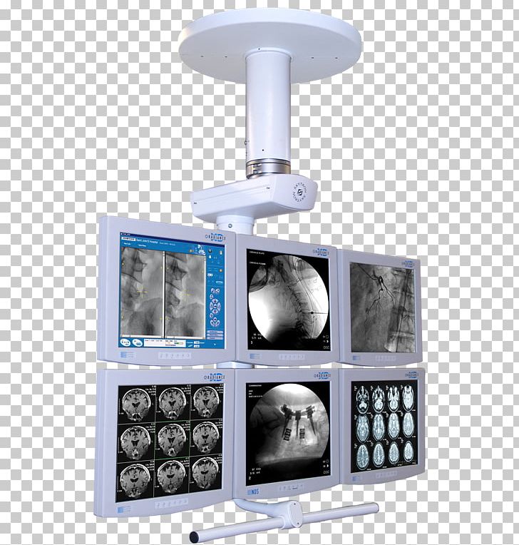 Hybrid Operating Room Surgery Operating Theater Computer Monitors Management PNG, Clipart, Ceiling, Computer Monitors, Data, Display Device, Hybrid Operating Room Free PNG Download