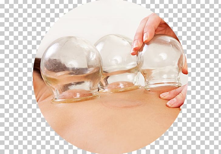 Pain In Spine Cupping Therapy Acupuncture Traditional Chinese Medicine PNG, Clipart, Acupuncture, Alternative Health Services, Cup, Cupping Therapy, Finger Free PNG Download