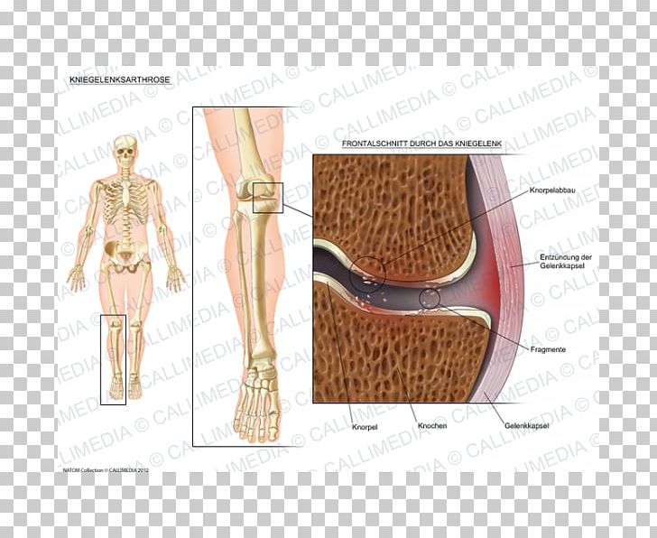 Shoulder Anatomy PNG, Clipart, Anatomy, Art, Human Leg, Joint, Knee Free PNG Download