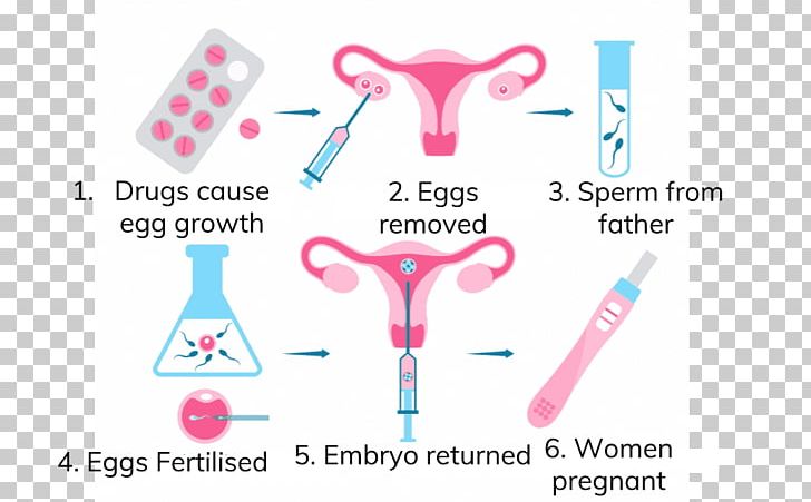 In Vitro Fertilisation Assisted Reproductive Technology Human Fertilization PNG, Clipart, Area, Artificial Insemination, Assisted Reproductive Technology, Brand, Fertility Free PNG Download