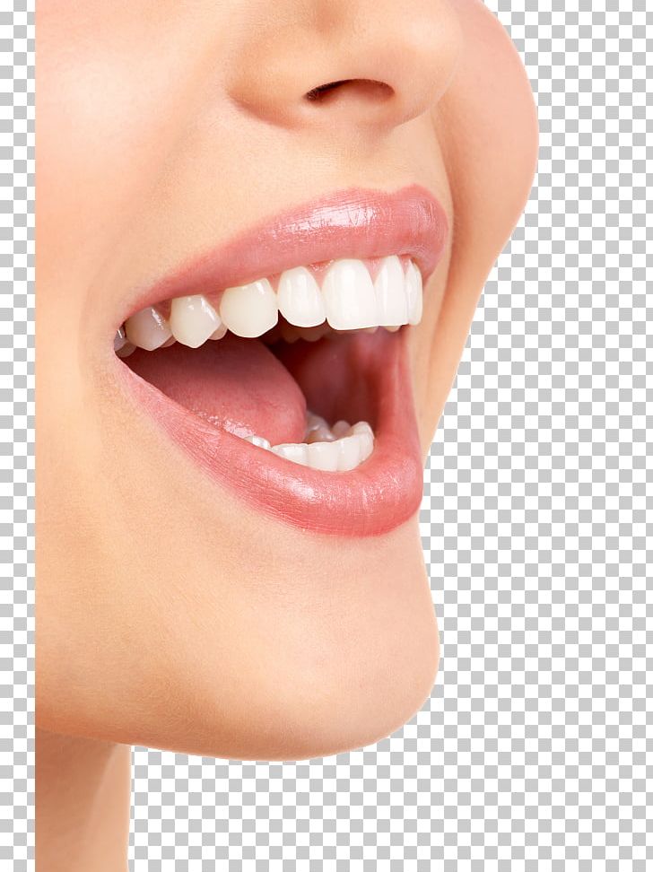 Dentistry Veneer Dental Hygienist Crown PNG, Clipart, Closeup, Cosmetic Dentistry, Dental Implant, Dental Public Health, Dental Surgery Free PNG Download