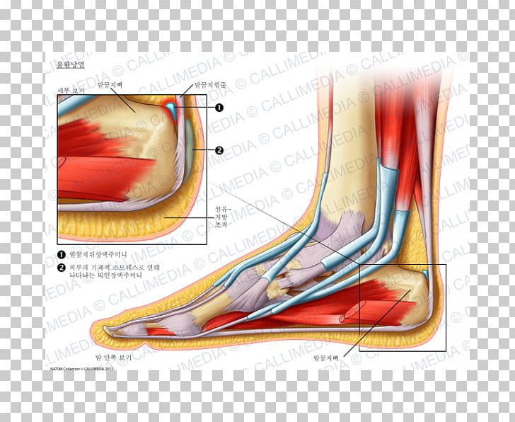 Foot Bursitis Synovial Bursa Elbow Knee PNG, Clipart, Anatomy, Ankle, Arm, Blood Vessel, Bursitis Free PNG Download