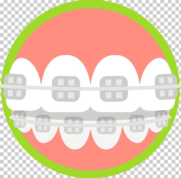 Cosmetic Dentistry Tooth Health Orthodontics PNG, Clipart, Area, Circle, Clear Aligners, Cosmetic Dentistry, Dental Braces Free PNG Download