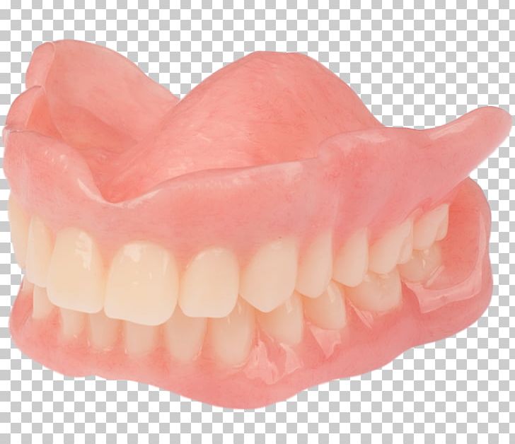 Tooth Dentures AvaDent Art Analog Signal PNG, Clipart, Analog Signal, Art, Avadent, Core, Dentistry At The Springs Free PNG Download