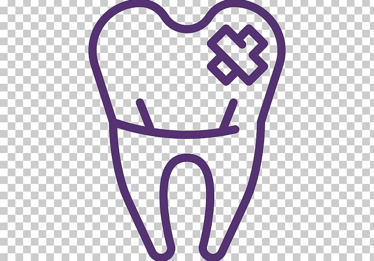 Dentistry Tooth Decay Cracked Tooth Syndrome Human Tooth PNG, Clipart, Cracked Tooth Syndrome, Dent, Dental Braces, Dental Extraction, Dental Implant Free PNG Download