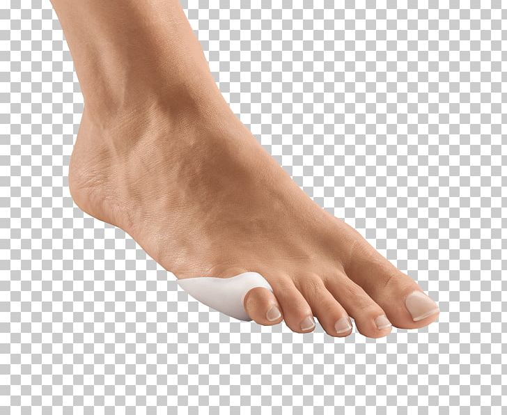 Toe Foot Orthotics Orthopaedics Little Finger PNG, Clipart, Ankle, Arm, Bone Fracture, Crus, Fifth Toe Free PNG Download