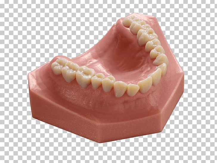 Dentistry Stratasys 3D Printing Orthodontics Printer PNG, Clipart, 3 D, 3 D Print, 3 D Printer, 3d Printers, 3d Printing Free PNG Download