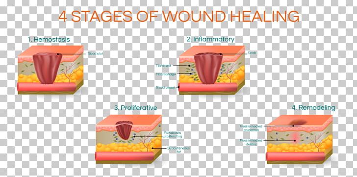 Wound Healing Scar Surgery PNG, Clipart, Acne, Brand, Breast Reconstruction, Heal, Healing Free PNG Download