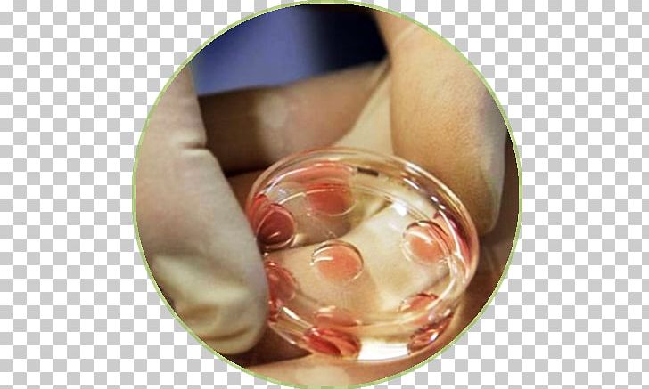 In Vitro Fertilisation In Vitro Fertilisation Pregnancy Semen PNG, Clipart, Child, Closeup, Crying, Dilemma, Fertilisation Free PNG Download