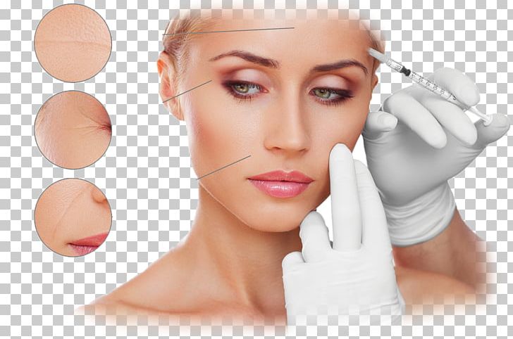 Plastic Surgery Wrinkle Botulinum Toxin RG Pro Laser PNG, Clipart, Aesthetic Medicine, Antiaging Cream, Beauty, Cheek, Chin Free PNG Download