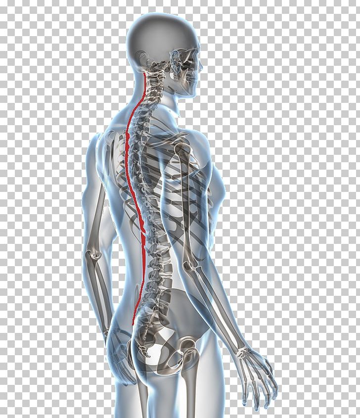 Paget's Disease Of Bone Chiropractic Pain In Spine Health PNG, Clipart,  Free PNG Download