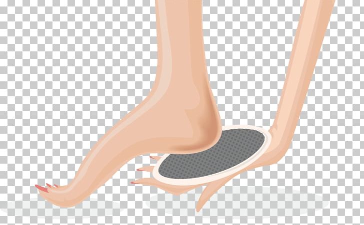 Foot Nail Skin Ulcer PNG, Clipart, Arm, Blister, Blog, Callus, Corn Free PNG Download