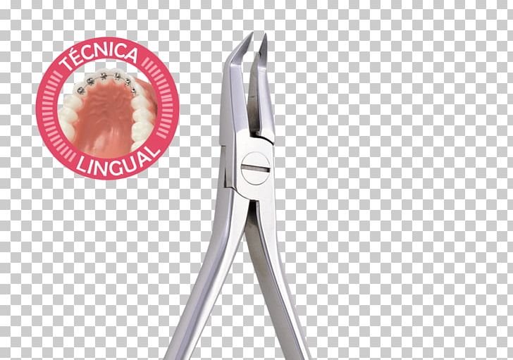Lingual Braces Dental Braces PNG, Clipart, Art, Dental Braces, Lingual Braces, Nipper, Tool Free PNG Download