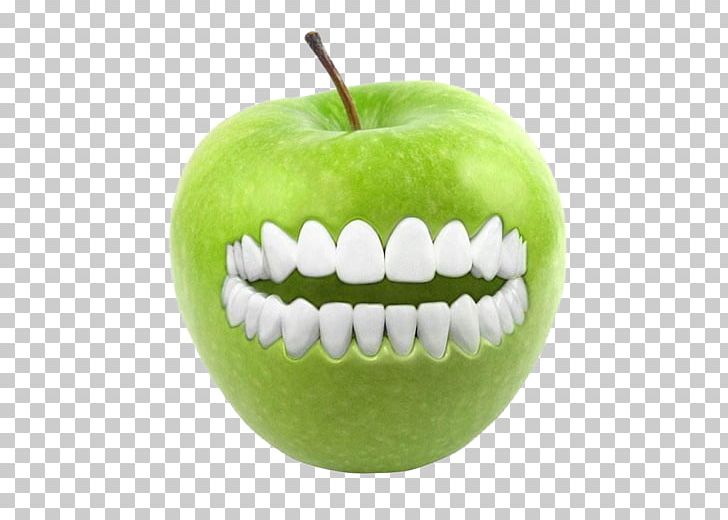 Tooth Pathology Dentistry Dentures Dental Extraction PNG, Clipart, Apple Fruit, Apple Logo, Apples, Apple Tree, Basket Of Apples Free PNG Download