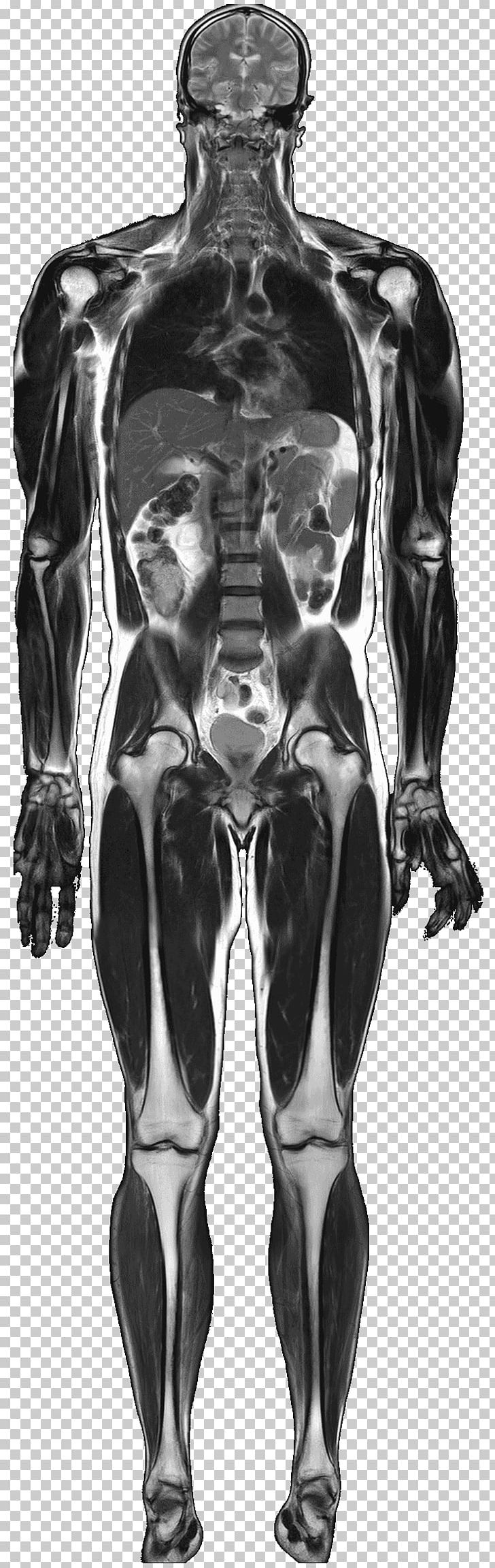 Magnetic Resonance Imaging Medical Imaging Anatomy Human Body Nuclear Magnetic Resonance PNG, Clipart, Anatomy, Arm, Black And White, Chest, Figure Drawing Free PNG Download
