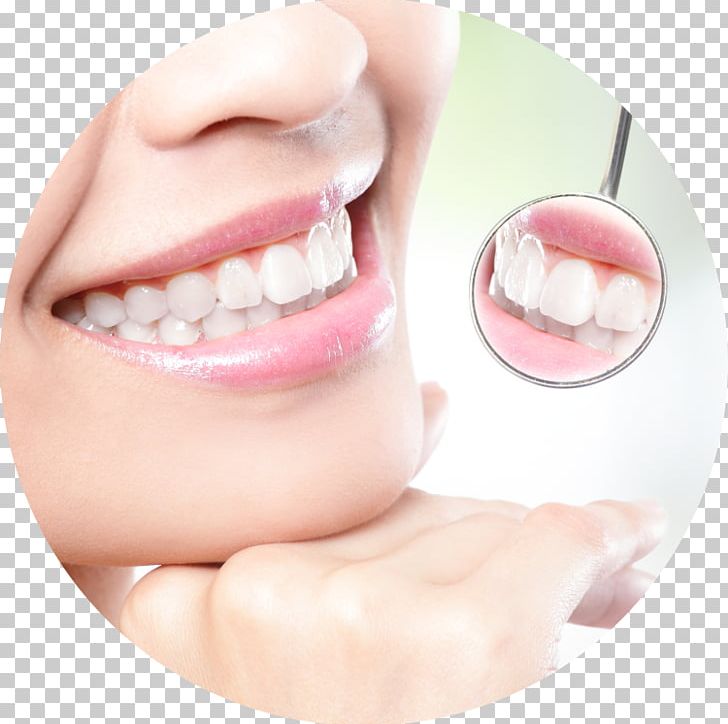 Tooth Whitening Cosmetic Dentistry Human Tooth PNG, Clipart, Activated Carbon, Charcoal, Cheek, Chin, Cosmetic Dentistry Free PNG Download