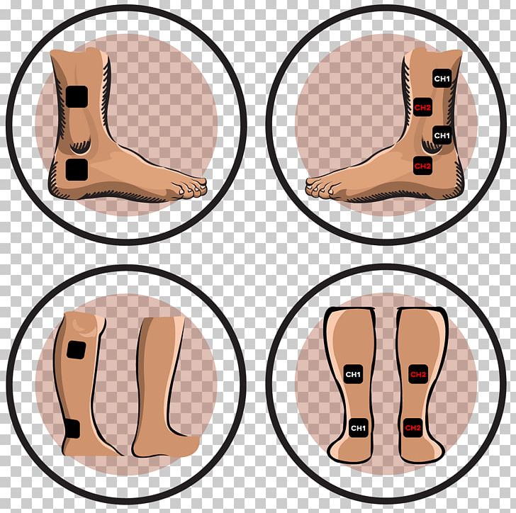 Thumb Transcutaneous Electrical Nerve Stimulation Electrical Muscle Stimulation Sprained Ankle PNG, Clipart, Ankle, Arm, Ear, Electrical Muscle Stimulation, Electrode Free PNG Download