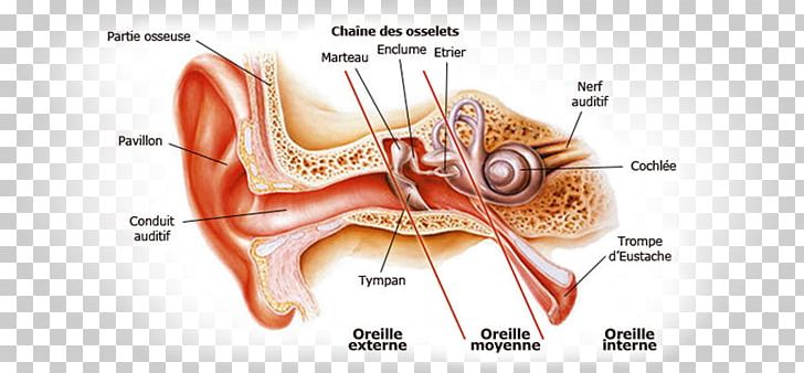 Otitis Externa Ear Canal Outer Ear Inner Ear PNG, Clipart, Abroad, Athletes, Audition, Auditory Event, Auditory System Free PNG Download