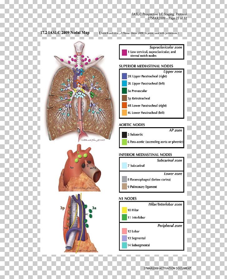 Lymph Node Lung Cancer Staging Lung Cancer Staging Anatomy PNG, Clipart, Anatomy, Cancer, Cancer Staging, Hilum, Joint Free PNG Download