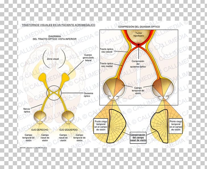 Acromegaly Nose Paper Human Behavior Body PNG, Clipart, Acromegaly, Angle, Area, Behavior, Body Free PNG Download