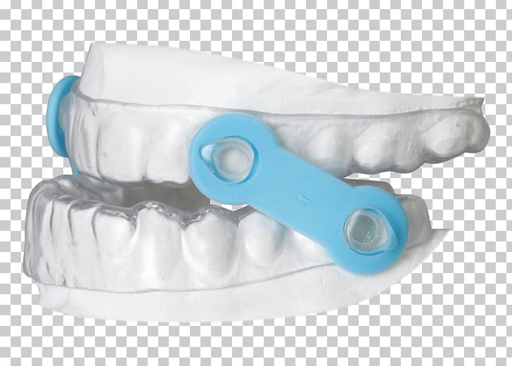 Obstructive Sleep Apnea Mandibular Advancement Splint Continuous Positive Airway Pressure PNG, Clipart, Apnea, Dentistry, Gergens Orthodontic Lab, Mandibular Advancement Splint, Miscellaneous Free PNG Download