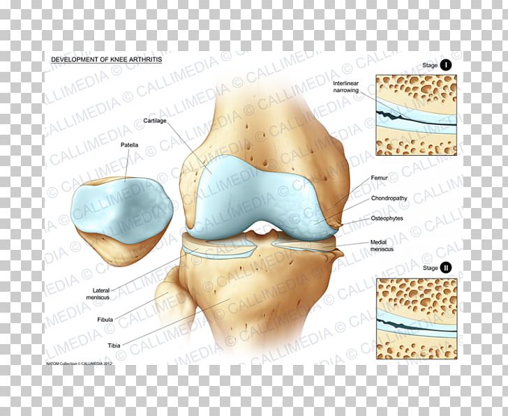 Human Anatomy Knee Human Body Tibia PNG, Clipart, Anatomy, Bone, Bone Fracture, Ear, Femur Free PNG Download