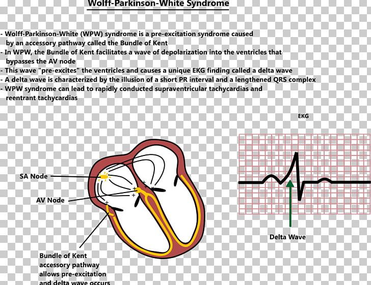 Line Angle PNG, Clipart, Angle, Area, Art, Diagram, Ecg Free PNG Download