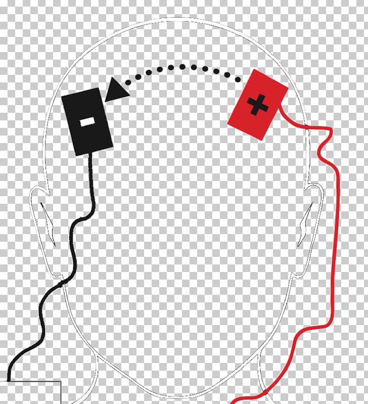 Transcranial Direct-current Stimulation Major Depressive Disorder Transcranial Magnetic Stimulation Depression Neuromodulation PNG, Clipart, Area, Depression, Direct Current, Direct Primary Care, Electric Current Free PNG Download