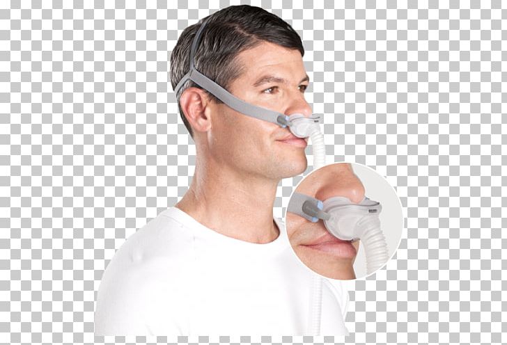 Continuous Positive Airway Pressure ResMed Sleep Apnea Mask PNG, Clipart, Apnea, Art, Cheek, Chin, Face Free PNG Download