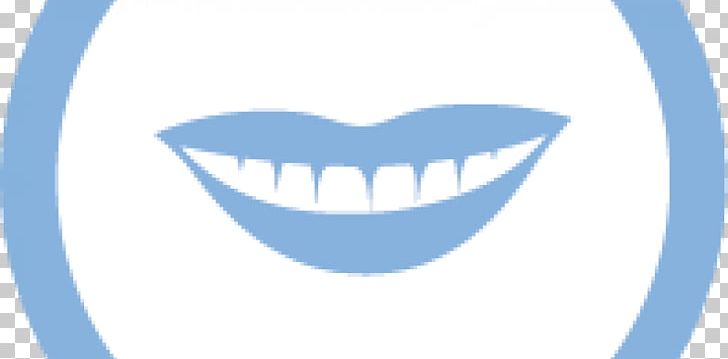 Tooth Cosmetic Dentistry Dental Restoration PNG, Clipart, Blue, Brand, Cheek, Cosmetic, Dental Free PNG Download
