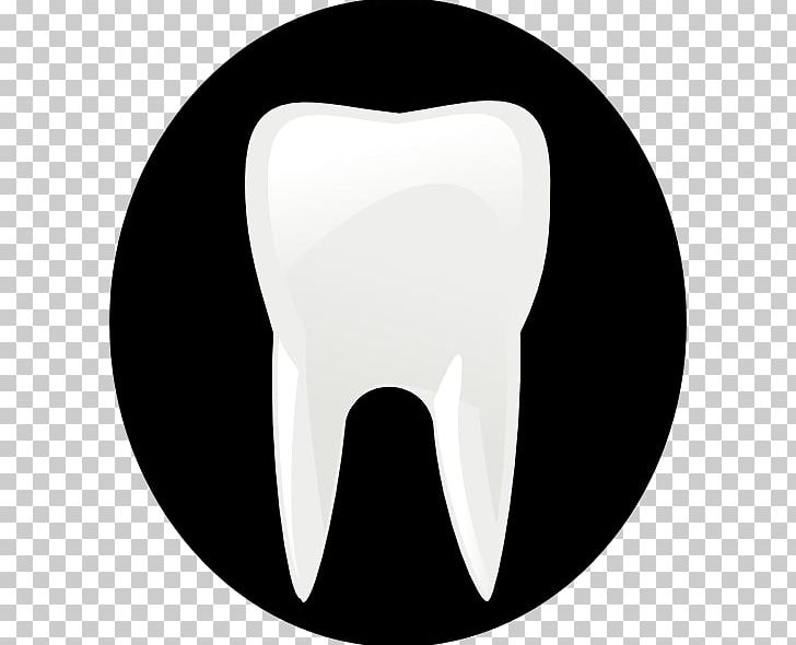 Tooth Free Content Molar PNG, Clipart, Black And White, Dental Surgery Pictures, Dentistry, Download, Free Content Free PNG Download